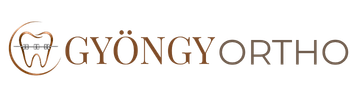Gyöngy ortho logó áttetsző bronz